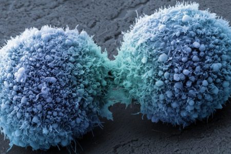 Pancreatic cancer cells completing cell division. (Visuals Unlimited, Inc./Dr. Stanley Flegler)