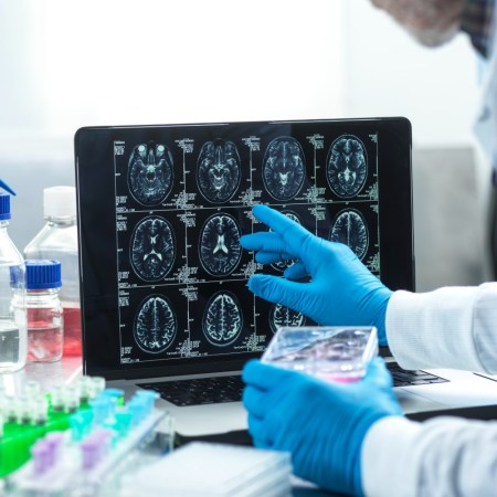 A scientist with gloves on reviewing brain scans