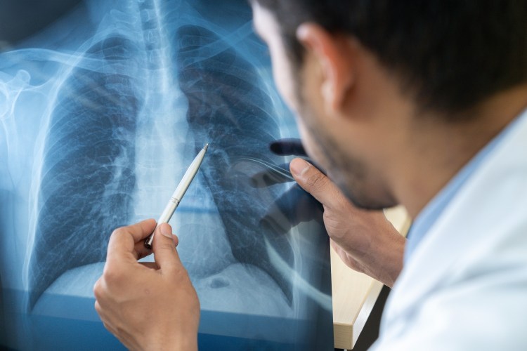 Doctor looking at a chest x-ray